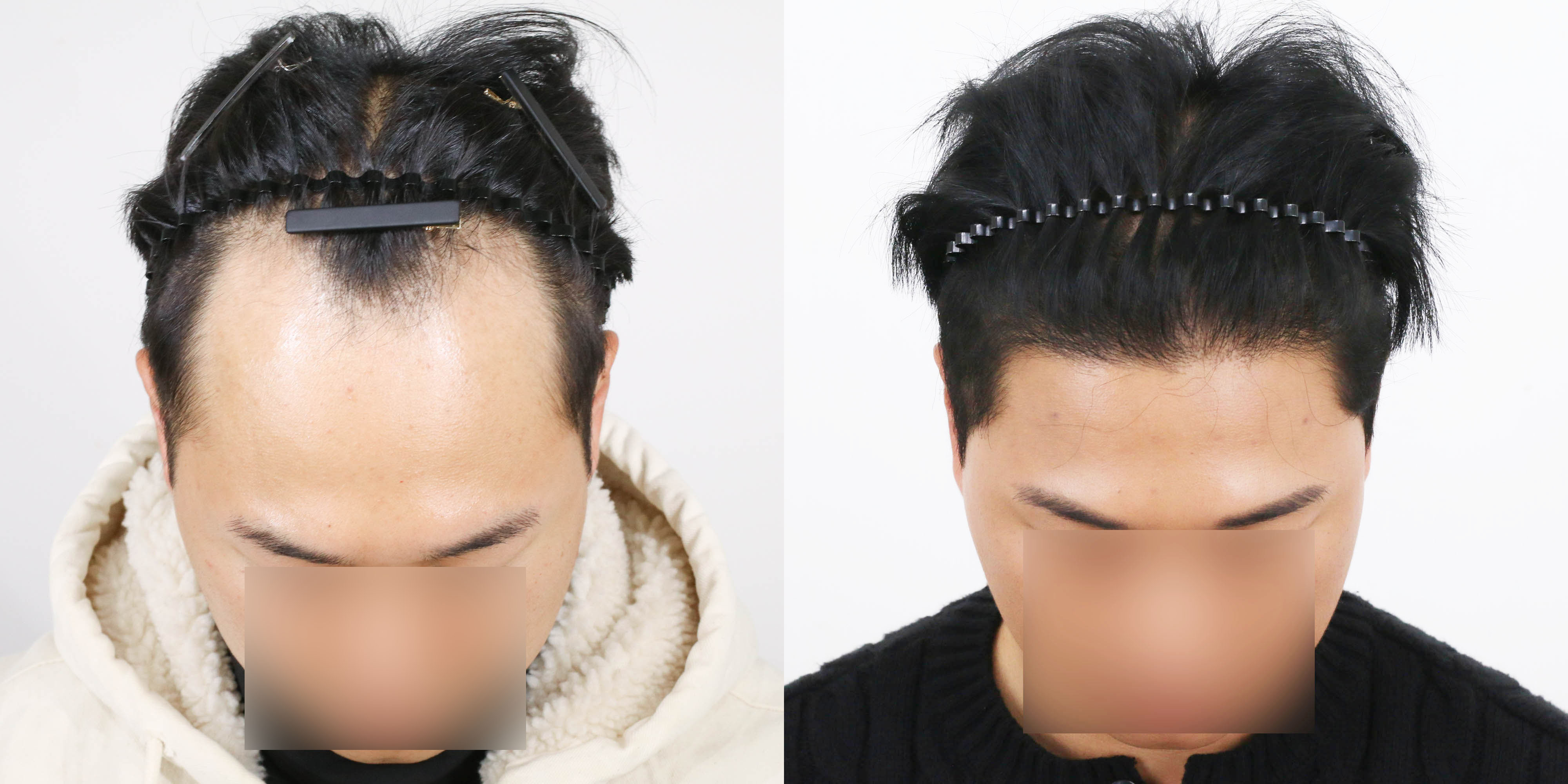 포토후기 이미지