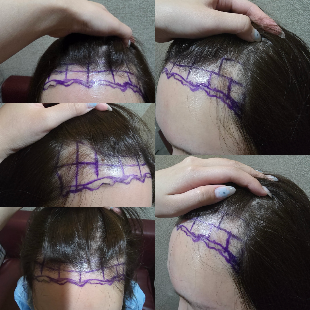 포토후기 이미지