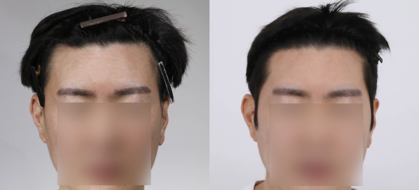 포토후기 이미지