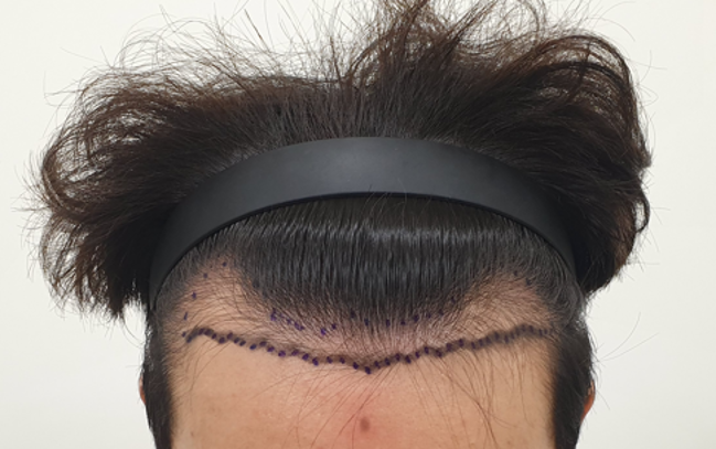포토후기 이미지