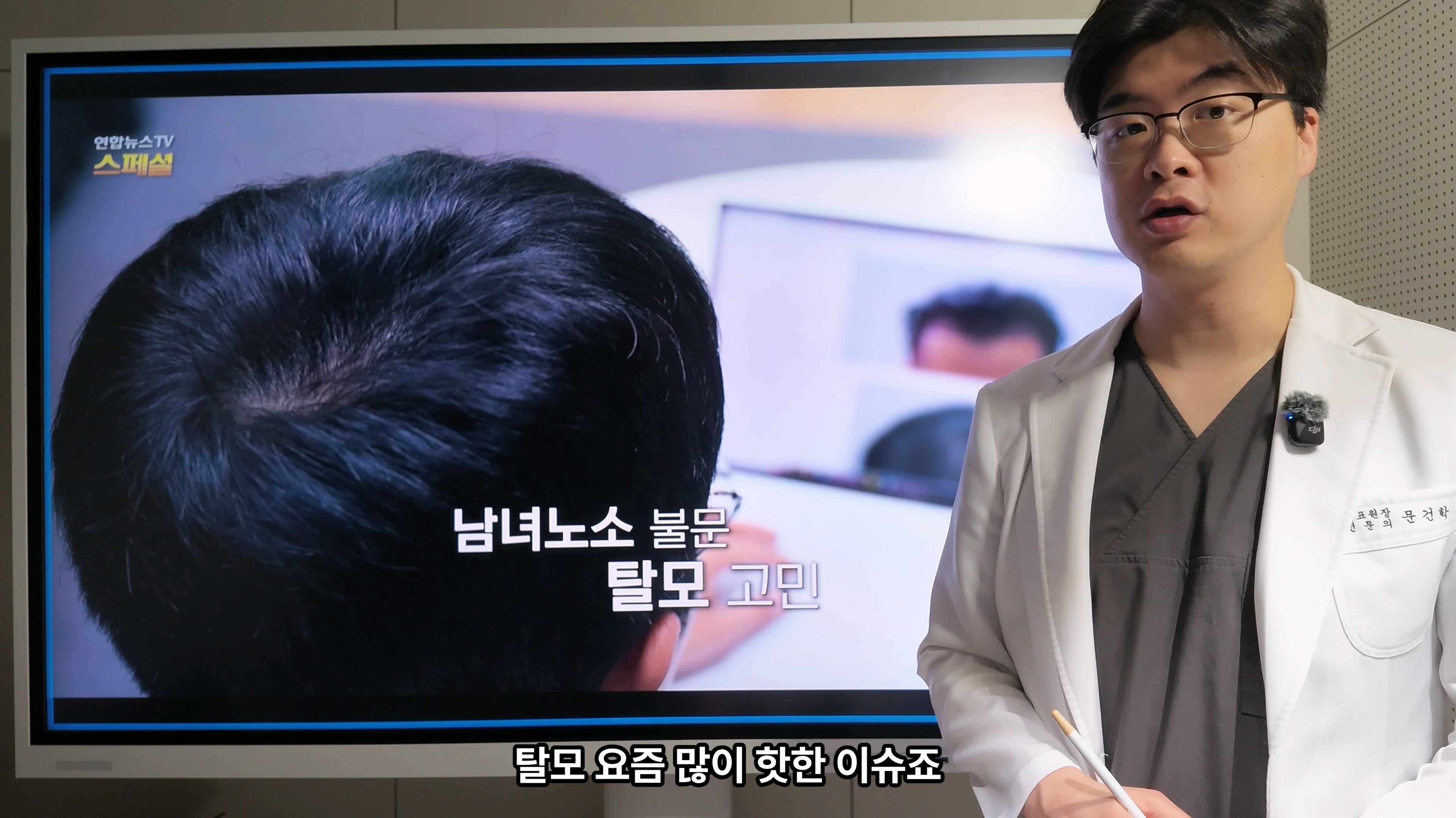 남성 모발이식, M자와 측면라인까지 함께 본 이유