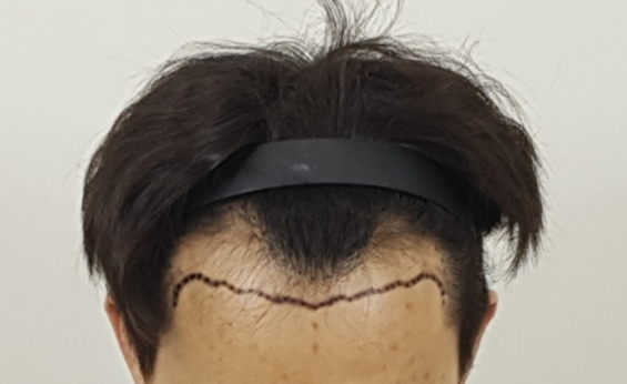 포토후기 이미지