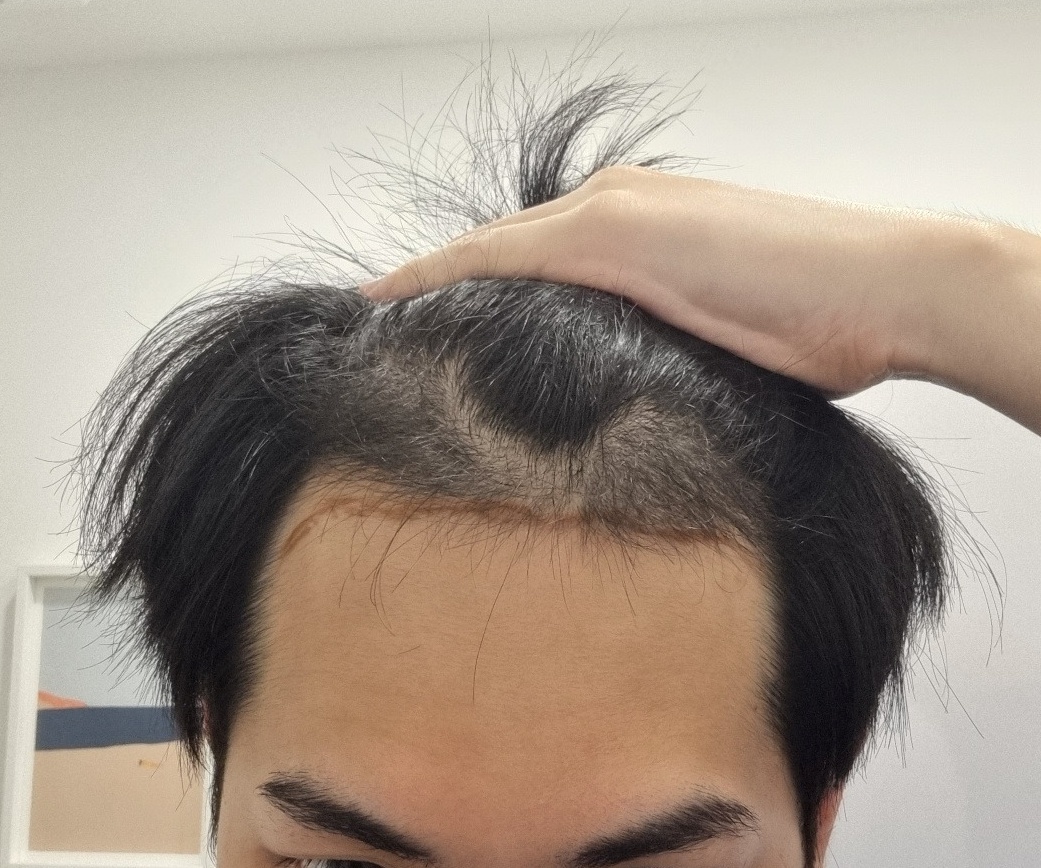 포토후기 이미지