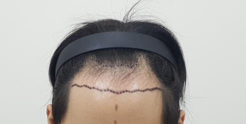 포토후기 이미지