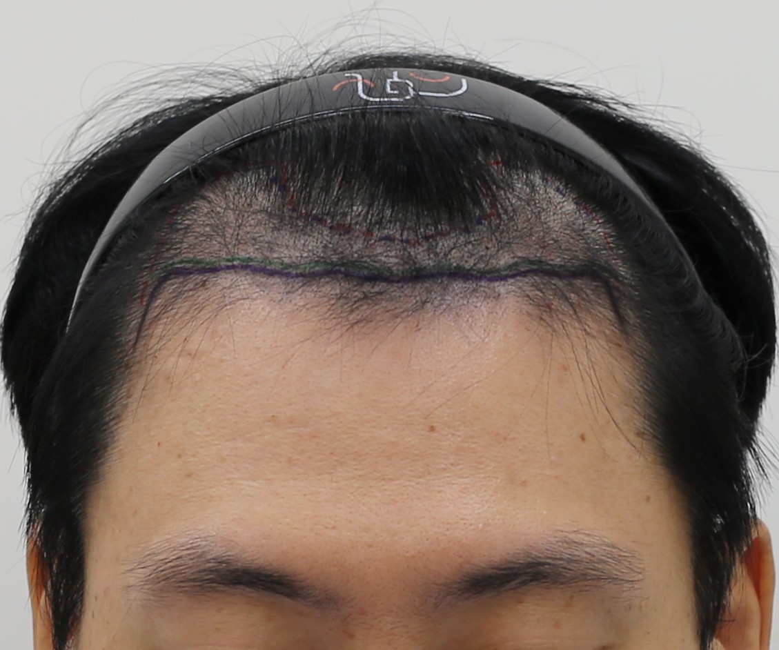 포토후기 이미지