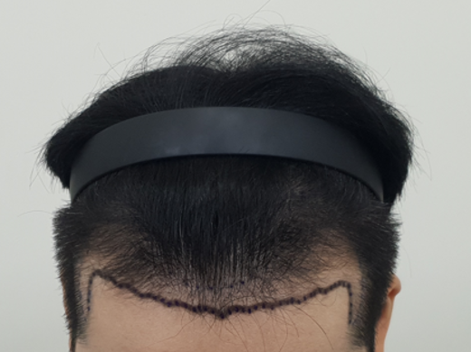 포토후기 이미지