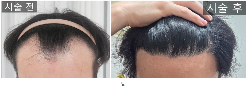 포토후기 이미지