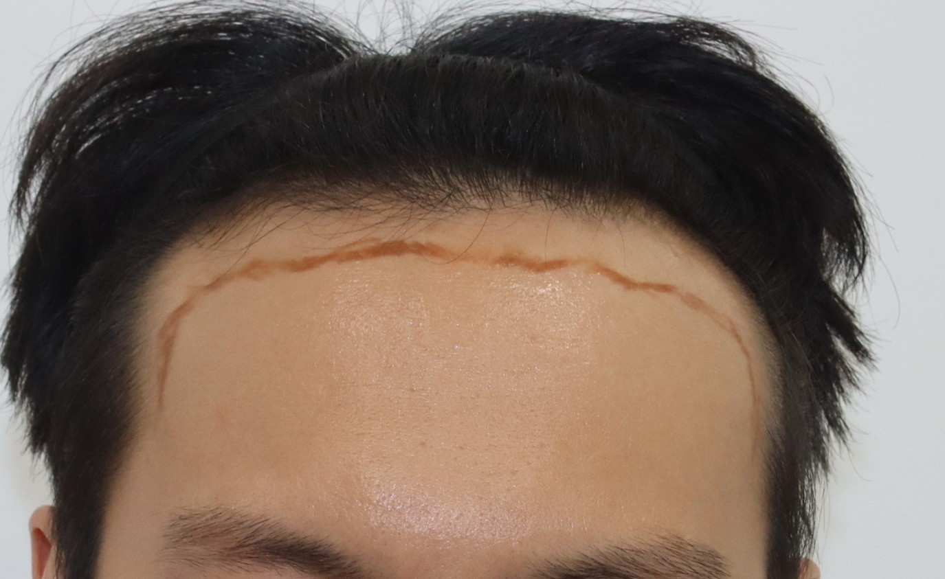 포토후기 이미지