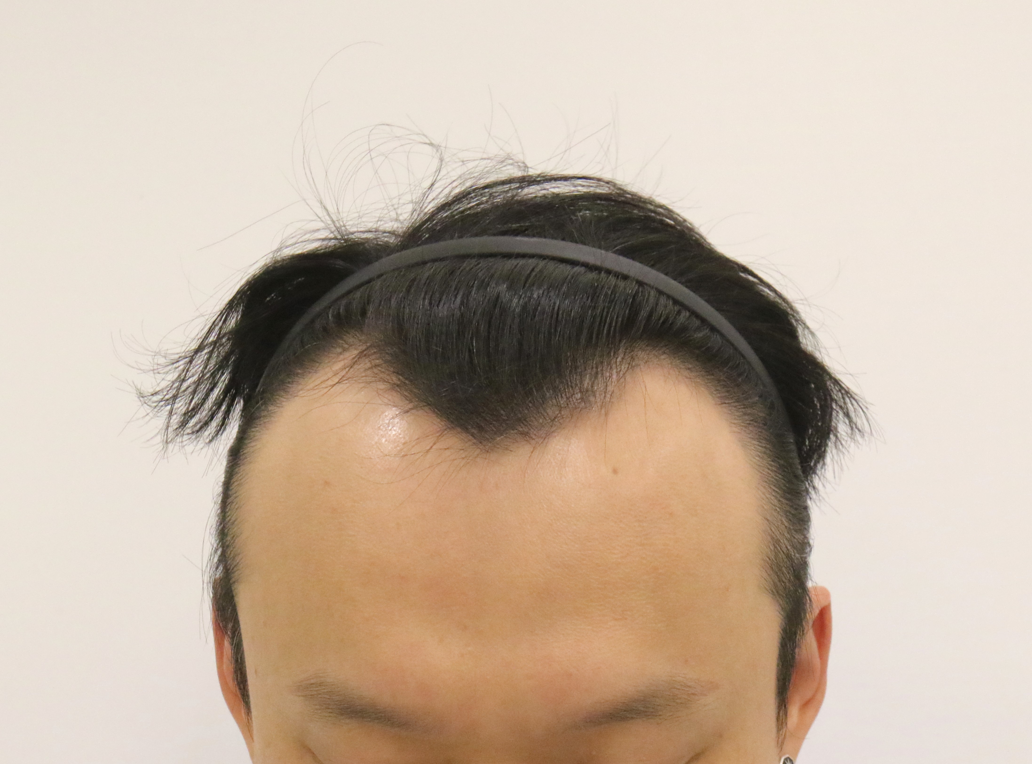포토후기 이미지