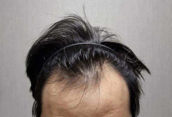 포토후기 이미지