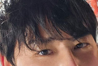 이태연수술후3.jpg