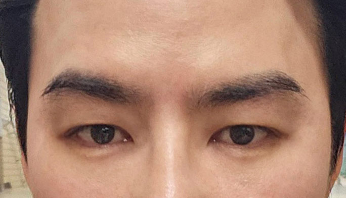 이태연수술후2.jpg