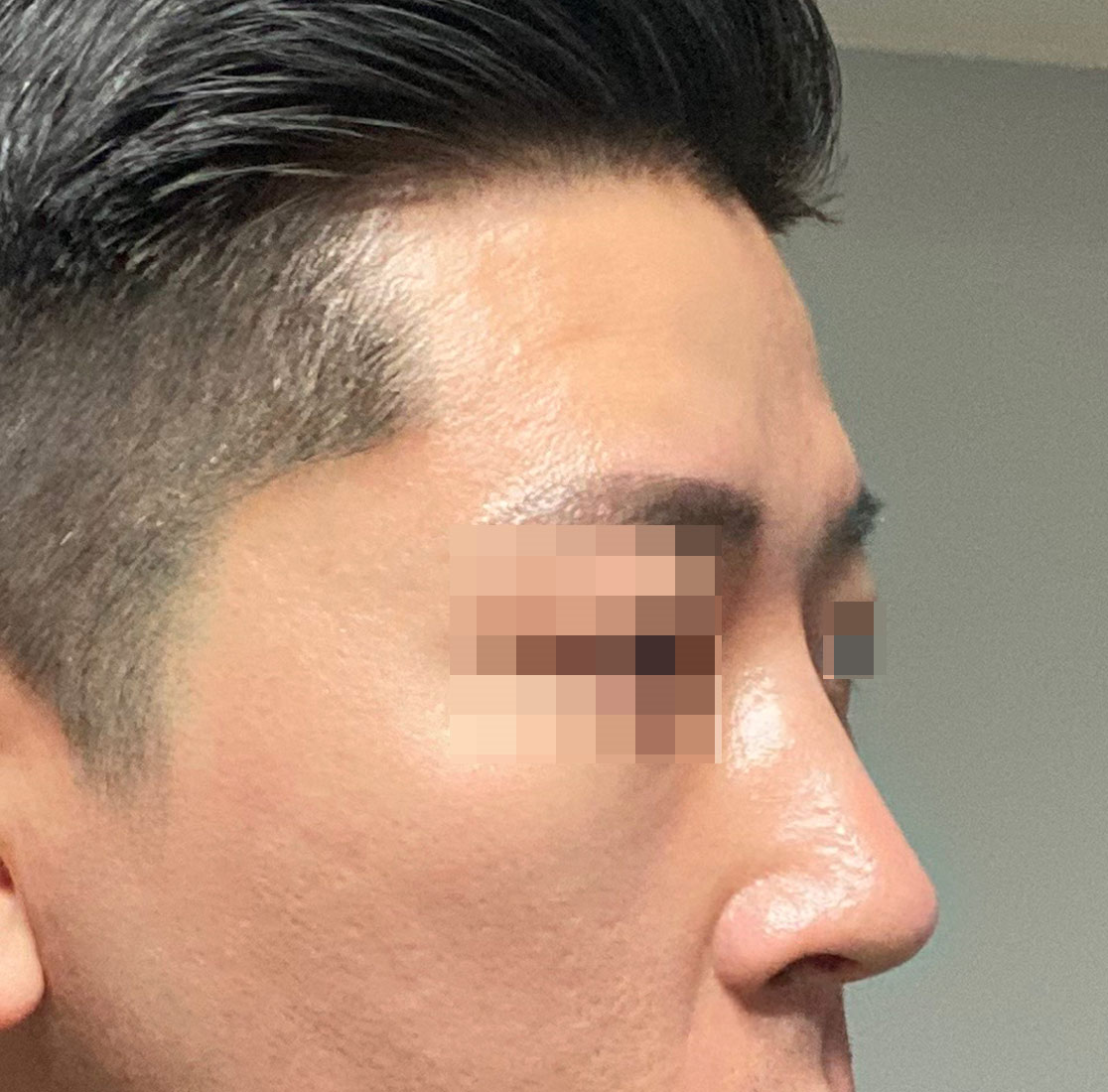 민홍기수술후2.jpg