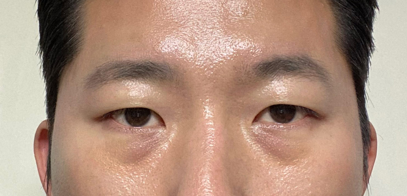 민홍기수술전.jpg