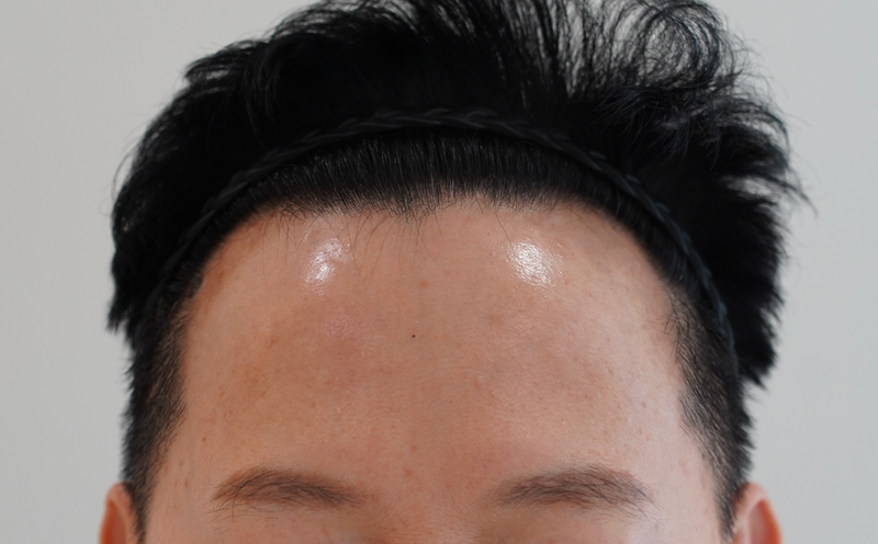 너무나 친절하고 상세한 시술 과정에 만족스럽습니다.