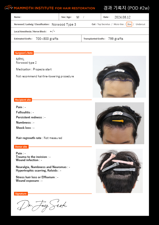 狎鴎亭マンモスヘアライン医院の男性M字ヘアライン矯正の2週目のレビューです。