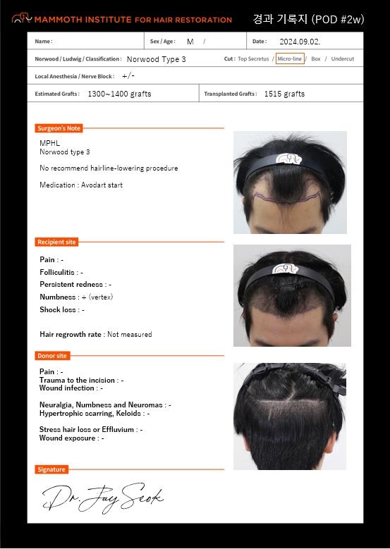 Apgujeong Mammoth Hairline Clinic is the second week of non-cutaneous mass hair transplantation.