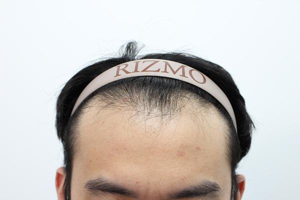 [Busan Lizmo] A frank review of the late 20th half of 3,000 hairs