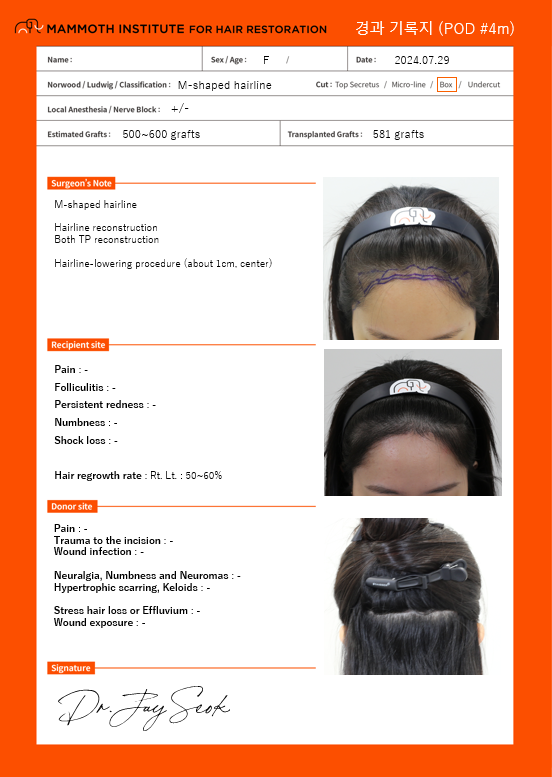 Apgujeong Mamos Hairline Diamond Slit Women's Hairline Correction Fourth Month Review (Director Seok Ji-woong)