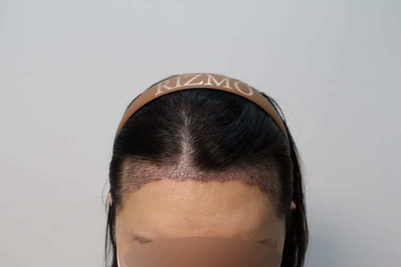 ce9ae143570c7622b20ad10bd658e7bc_1743159787_224.png