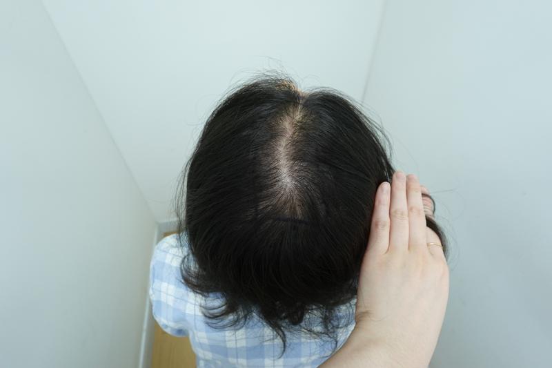 자라다의원에서 수술받았어요