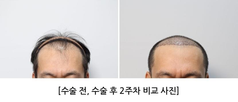6538a9baab5c80a809a6db8548cf7609_1745570246_119.jpg