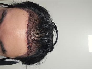 7be7d429282ceaeaef7bd025d1fc70e0_1745319683_0279.jpg 7be7d429282ceaeaef7bd025d1fc70e0_1745319683_0279.jpg