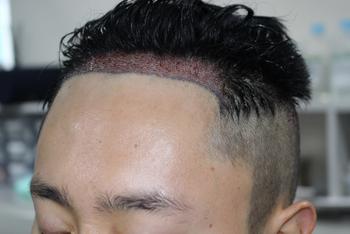 76171dfc35a1bee0087a825801c5ea09_1747038357_4918.jpg 76171dfc35a1bee0087a825801c5ea09_1747038357_4918.jpg