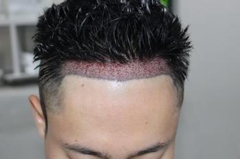 76171dfc35a1bee0087a825801c5ea09_1747038358_2895.jpg 76171dfc35a1bee0087a825801c5ea09_1747038358_2895.jpg