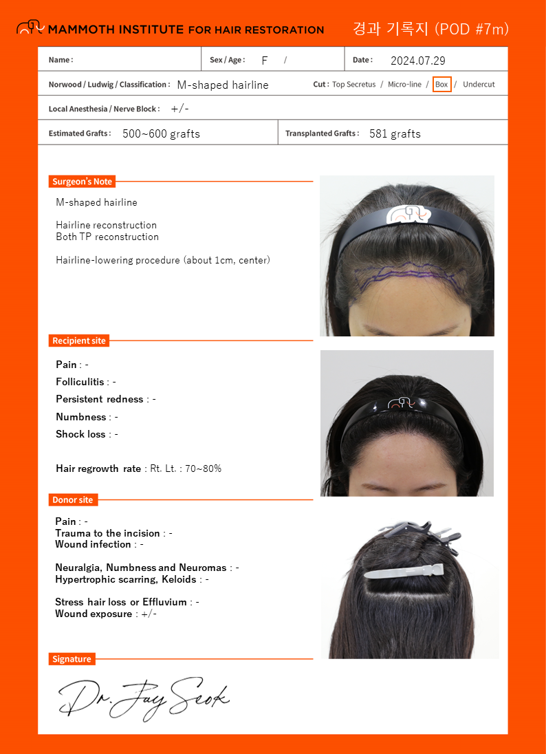 Apgujeong Mamos Hairline Diamond Slit Women's Hairline 7th Month Review (Director Seok Ji-woong)