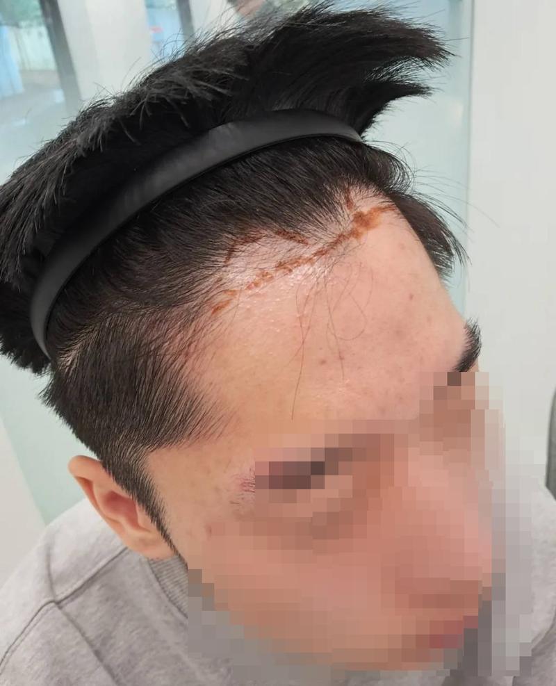 予算のことで心配しましたが、移植をよく受けることができました もう7ヶ月が経ちましたね
