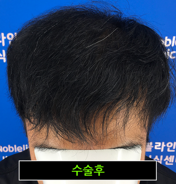 27eedd6c5a15c10f6d4eb2f287f605a0_1751867342_8646.png