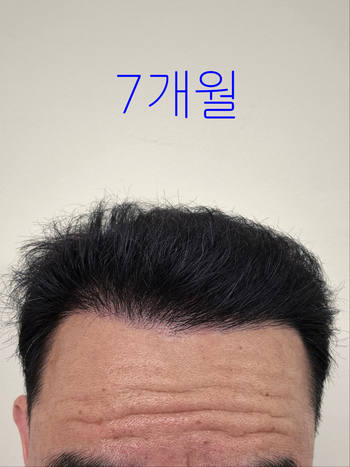 572e0125f0f5bdcb50df170476e96bd1_1751505198_3218.png