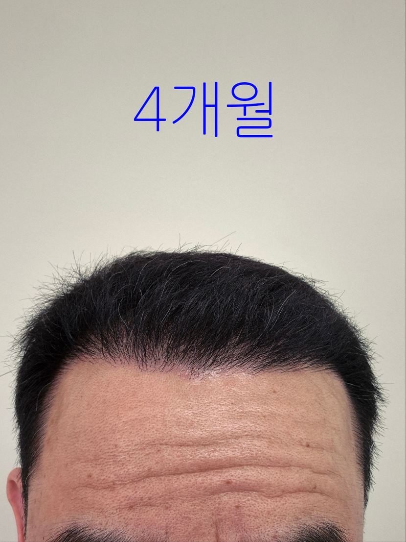 572e0125f0f5bdcb50df170476e96bd1_1751505198_6197.png