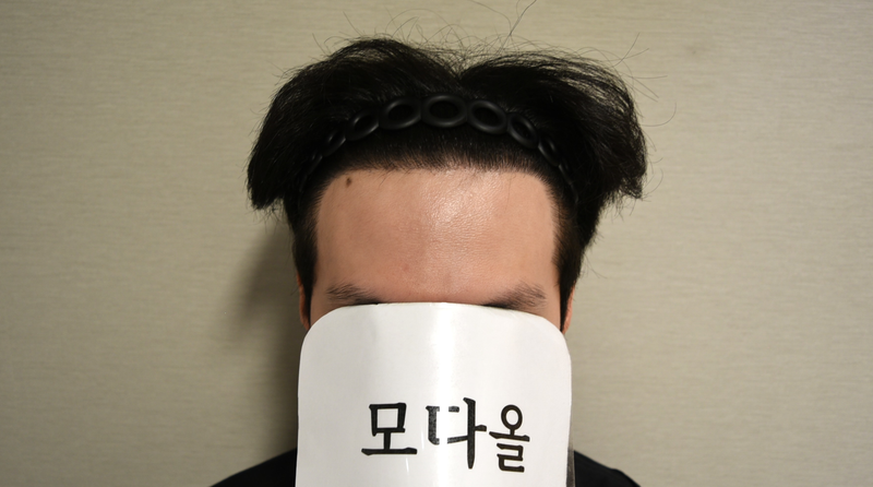 [모다올 비절개 모발이식 양유군 원장님] M자 + 측면 +구렛 이식 7개월 경과