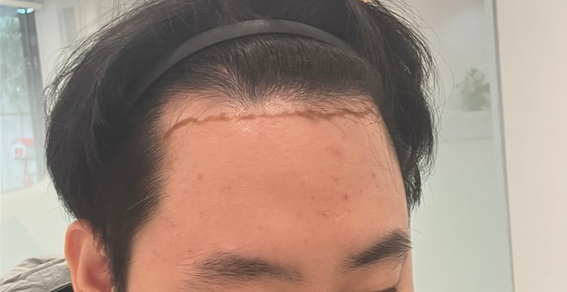포토후기 이미지