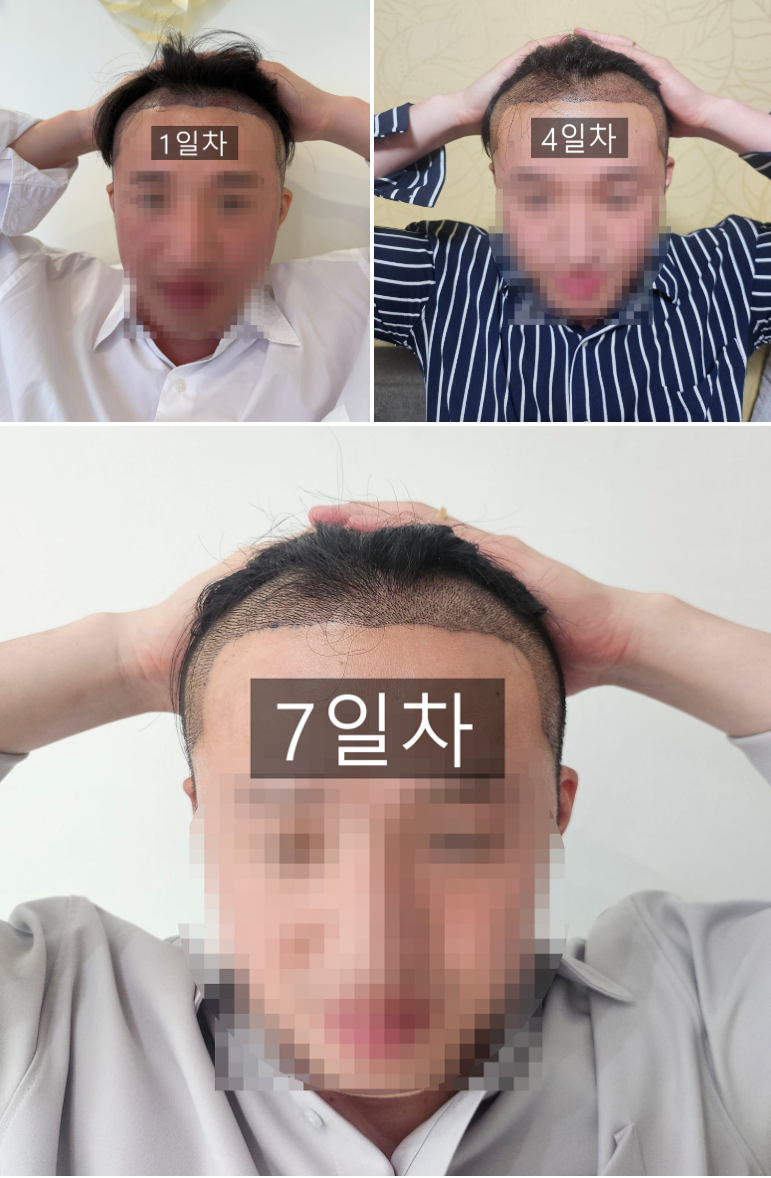 포토후기 이미지