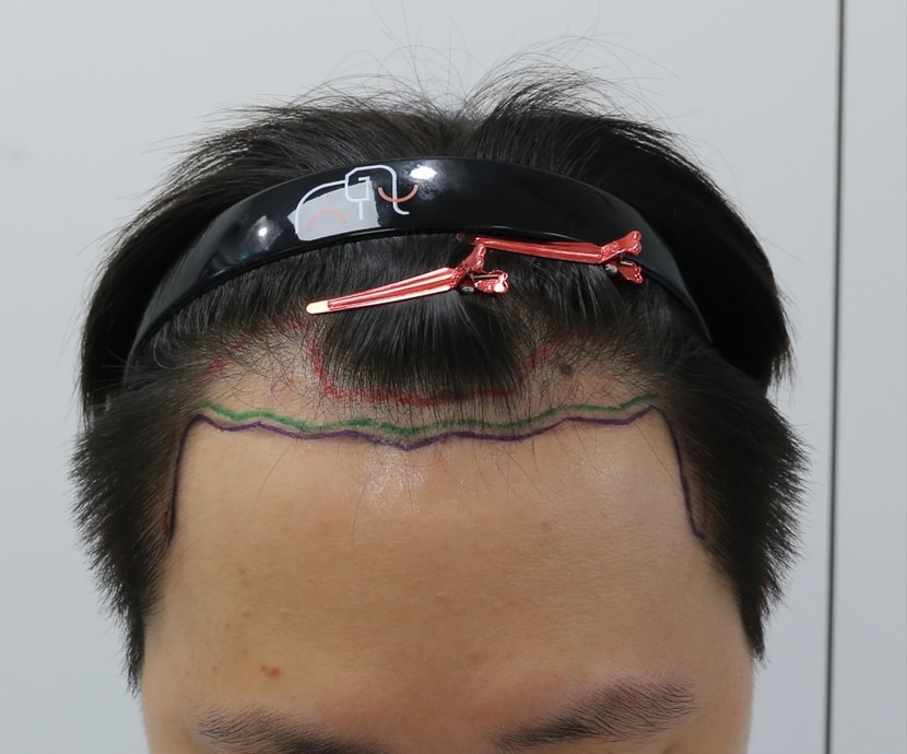 022e065f022b0373223327290c99c6a0_1761454794_44.jpg 022e065f022b0373223327290c99c6a0_1761454794_44.jpg