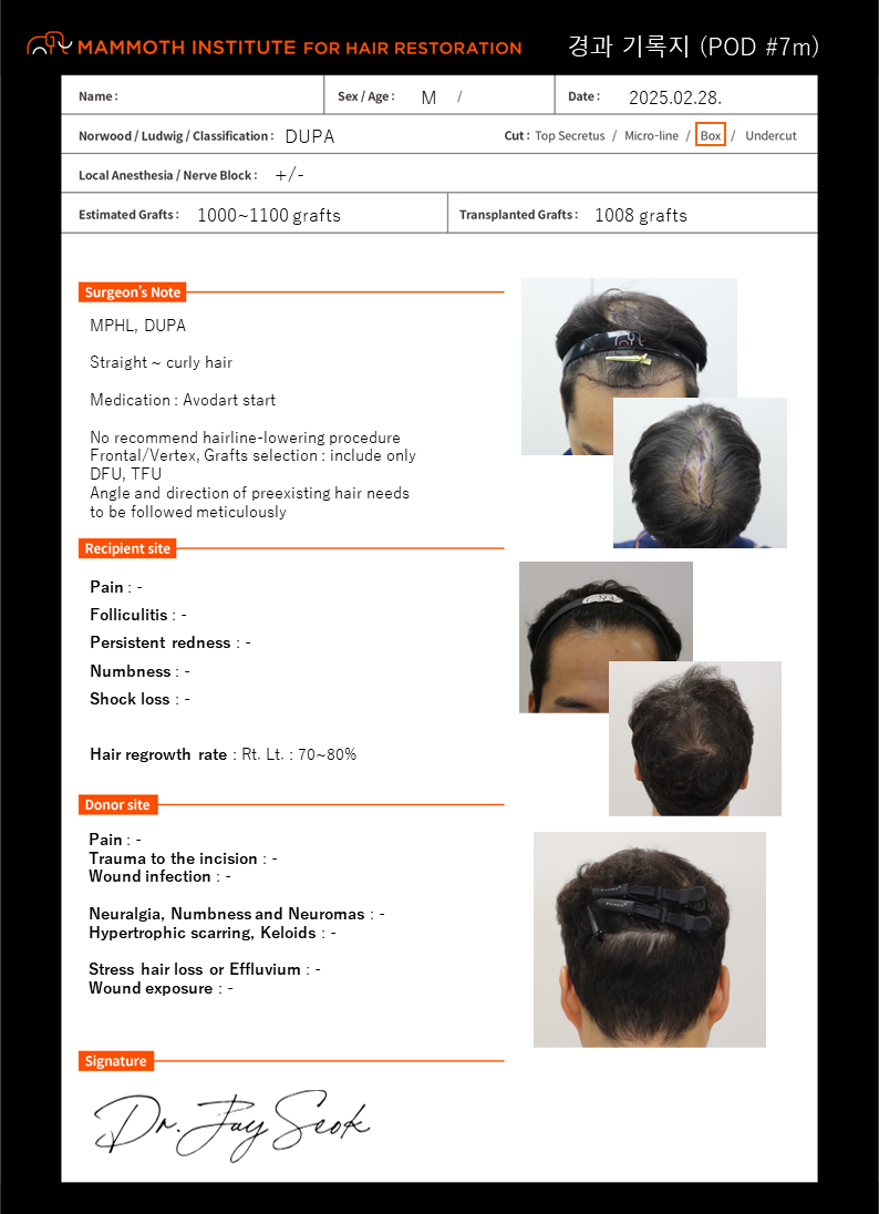 Apgujeong Mammoth Hair Restoration Center Hairline Diffusive Hair Loss Surgery 218th Review