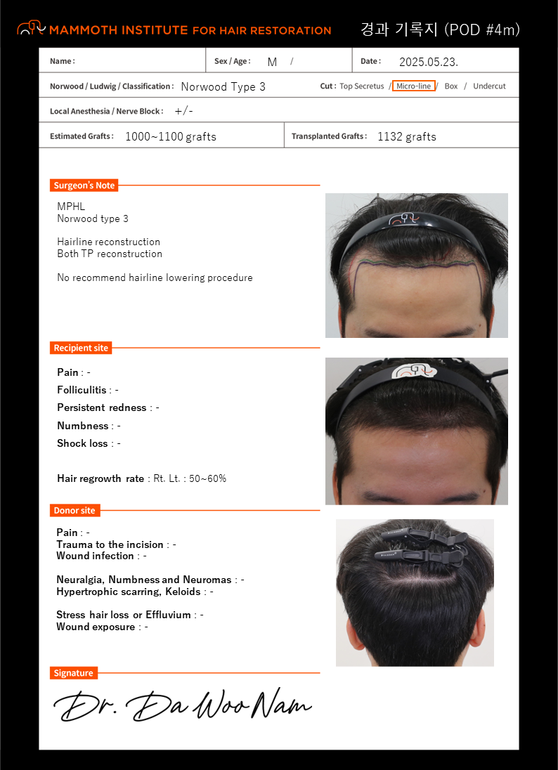 It's a four-month progress check of Nam Da-woo's non-cut Hair Transplant in Apgujeong Mammoth Hair Restoration Center.