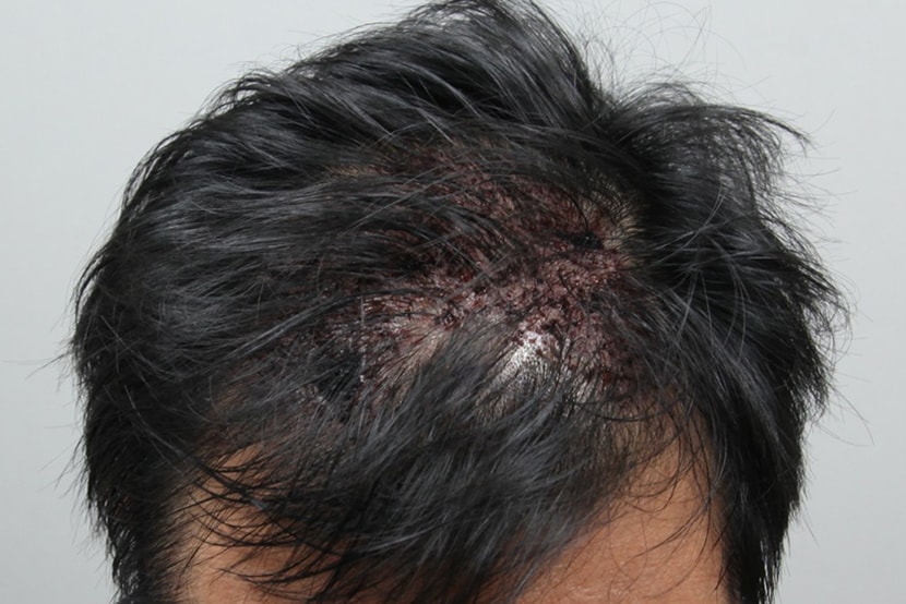 a927234c576f04d02e03709c8638e114_1761632876_4964.jpg a927234c576f04d02e03709c8638e114_1761632876_4964.jpg