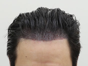 dcd396b5a5006a5ac3a6acdda80a6903_1761292766_8265.jpg dcd396b5a5006a5ac3a6acdda80a6903_1761292766_8265.jpg