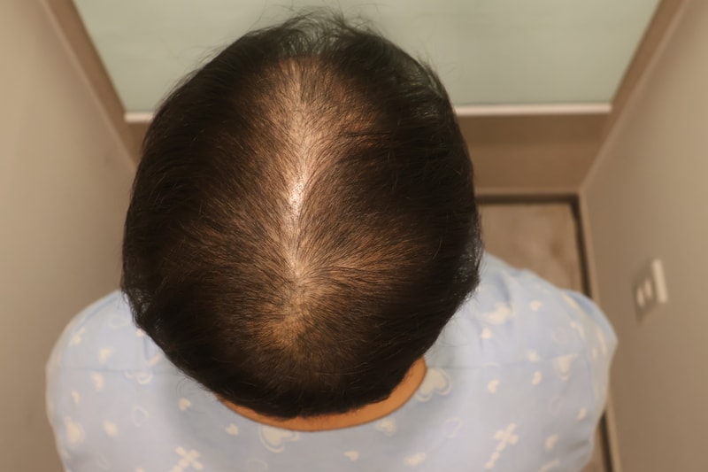 포토후기 이미지