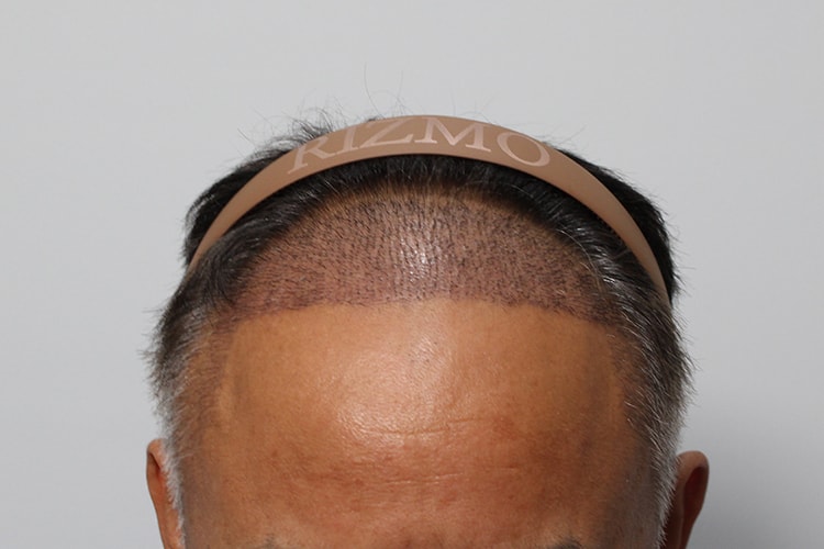 e277ce7e2e63b2431b933e66e12412b5_1761706373_5551.jpg e277ce7e2e63b2431b933e66e12412b5_1761706373_5551.jpg