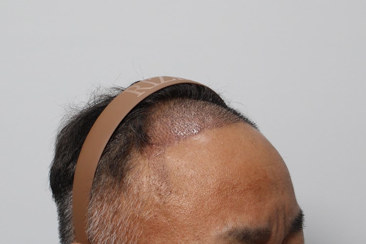 e277ce7e2e63b2431b933e66e12412b5_1761706373_6385.jpg e277ce7e2e63b2431b933e66e12412b5_1761706373_6385.jpg