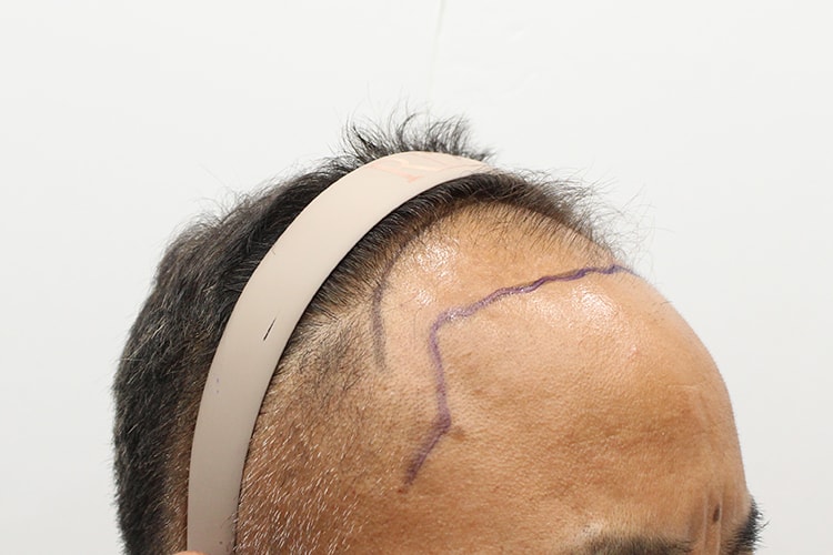 e277ce7e2e63b2431b933e66e12412b5_1761706373_7971.jpg e277ce7e2e63b2431b933e66e12412b5_1761706373_7971.jpg