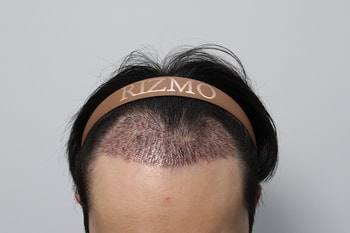 e277ce7e2e63b2431b933e66e12412b5_1761718399_9004.jpg e277ce7e2e63b2431b933e66e12412b5_1761718399_9004.jpg