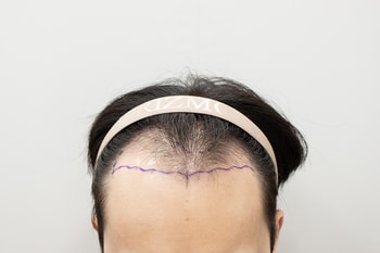 e277ce7e2e63b2431b933e66e12412b5_1761718400_0453.jpg e277ce7e2e63b2431b933e66e12412b5_1761718400_0453.jpg