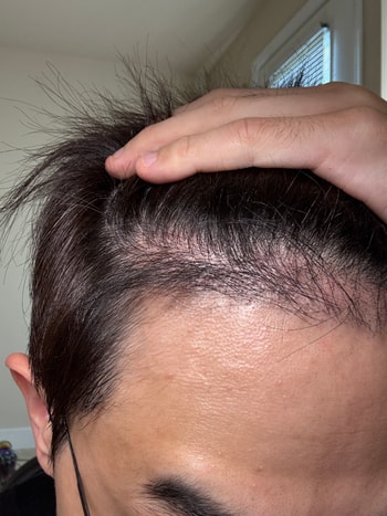 e8f22a4a97cd7e39afeb0fa0d3249926_1761564443_392.jpg e8f22a4a97cd7e39afeb0fa0d3249926_1761564443_392.jpg