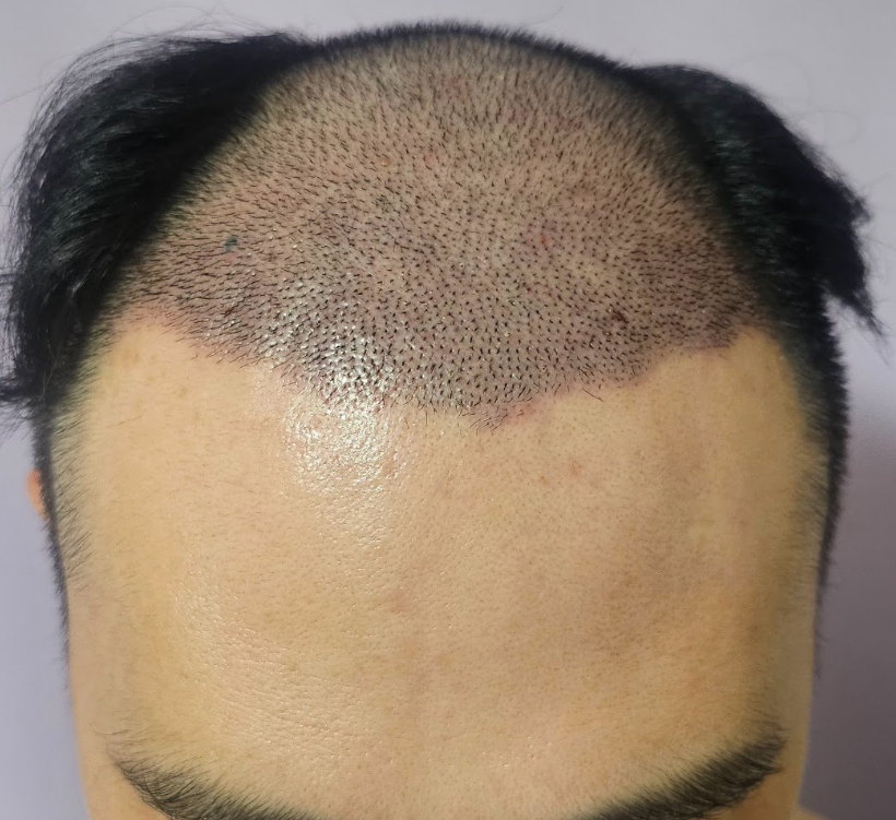 fc41e2dac7d775fc98aaaba648773017_1759628042_6468.png